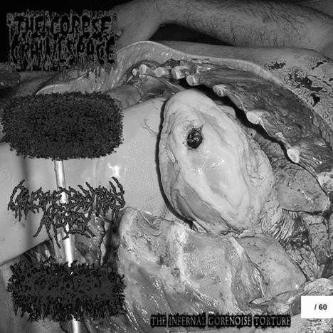 Gruesome Bodyparts Autopsy : The Infernal Gorenoise Torture Gruesome Bodyparts Autopsy : The Infernal Gorenoise Torture